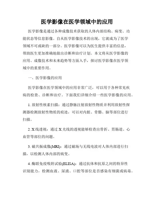 医学影像在医学领域中的应用