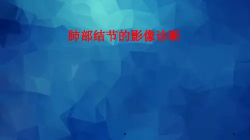 肺部结节影像诊断