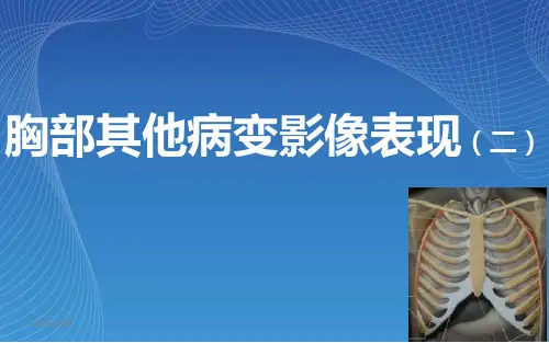 【影像诊断课件】胸部其他相关病变2(示教片)