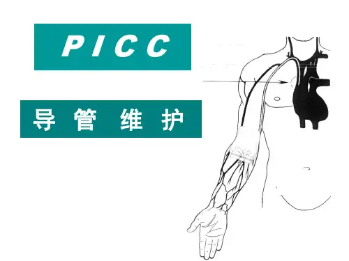 PICC导管维护
