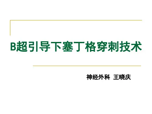 塞丁格