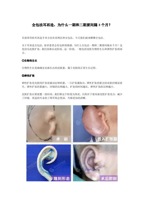 全包法耳再造,为什么一期和二期要间隔3个月？