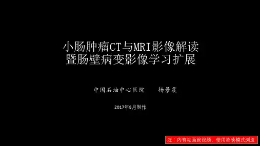 小肠肿瘤CT与MRI解读暨肠壁影像学习扩展