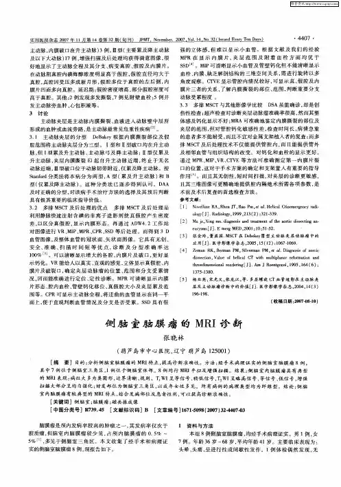 侧脑室脑膜瘤的MRI诊断