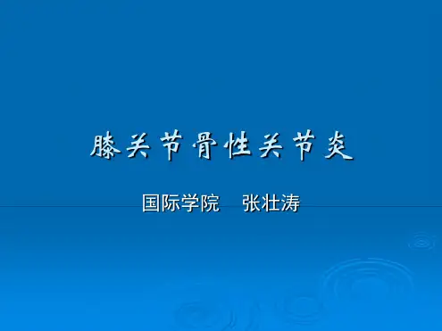 完整版膝关节骨性关节炎