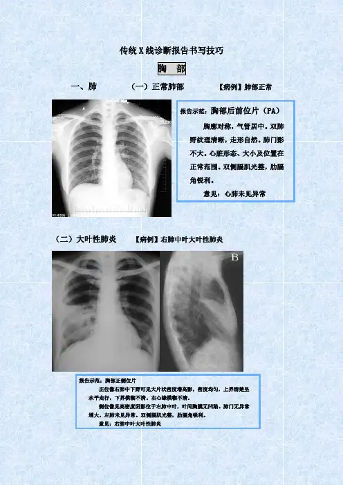 肺部诊断报告 2