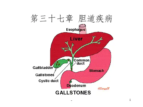 胆道疾病学习