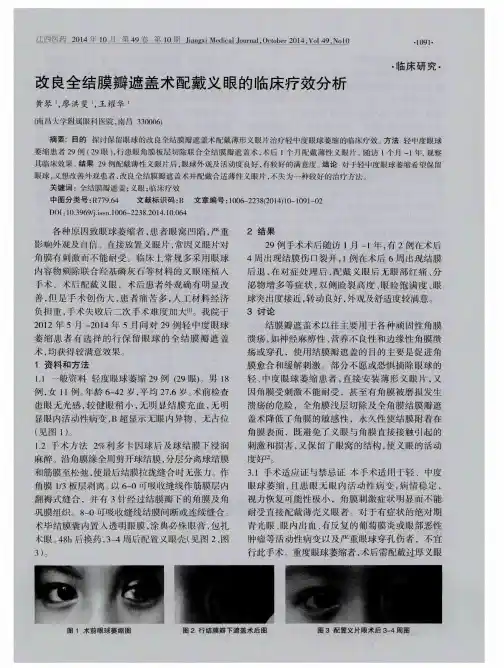 改良全结膜瓣遮盖术配戴义眼的临床疗效分析
