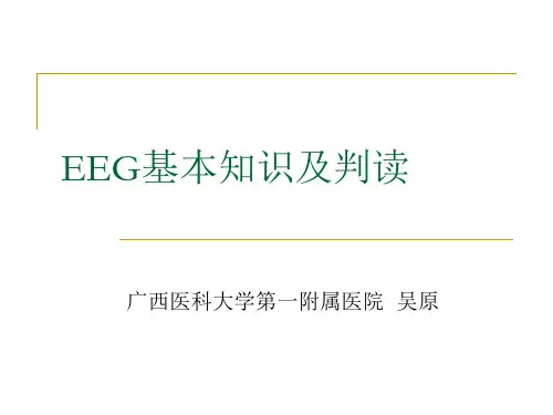 脑电图基本知识及判读
