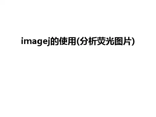 最新imagej的使用(分析荧光图片)