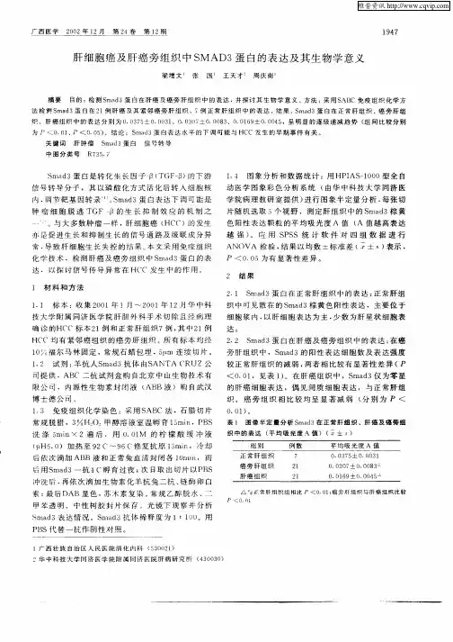 肝细胞癌及肝癌旁组织中SMAD3蛋白的表达及其生物学意义
