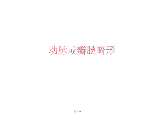 《先天性心脏病心电》PPT课件