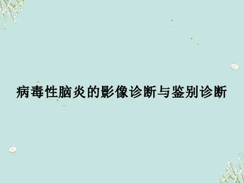 病毒性脑炎的影像诊断与鉴别诊断