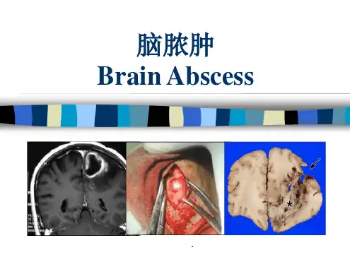 脑脓肿版本课件