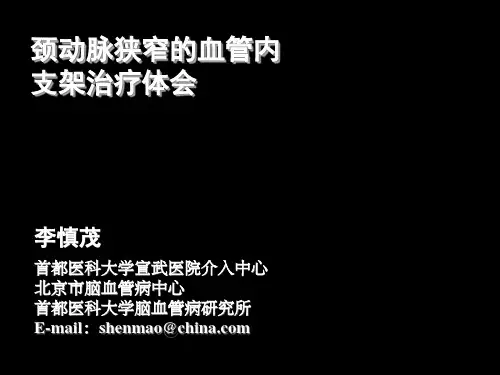 颈动脉狭窄的血管内治疗