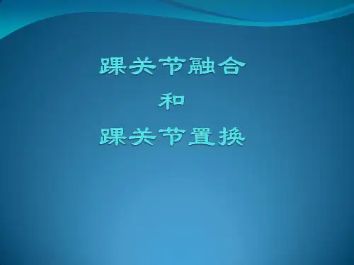 【源版】踝关节融合和置换