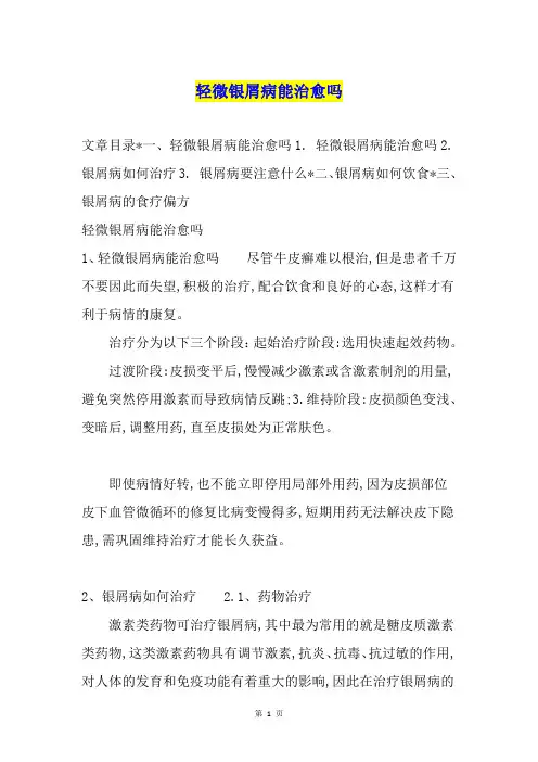 轻微银屑病能治愈吗