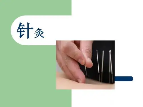 针灸