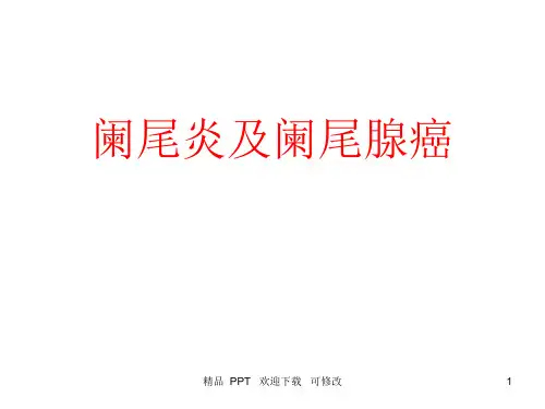 阑尾炎及阑尾肿瘤精品课件