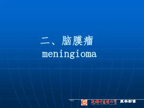 脑膜瘤ppt课件