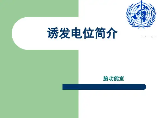 诱发电位简介
