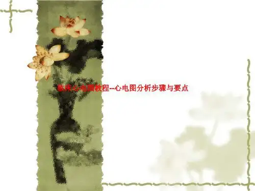 临床心电图教程--心电图分析步骤与要点