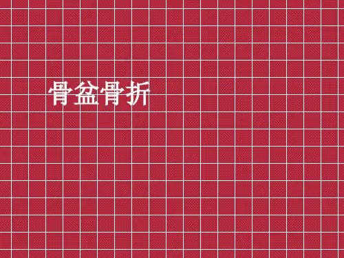 骨盆骨折患者护理要点