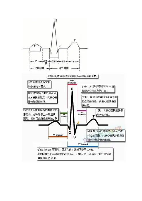 心电图基础知识 2