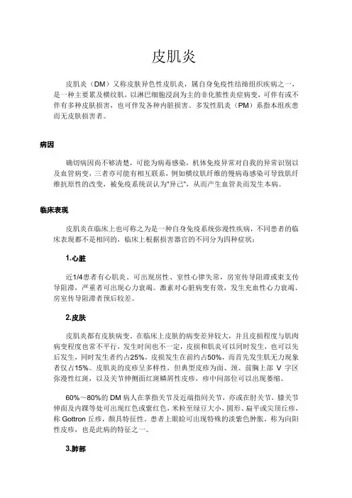 皮肌炎