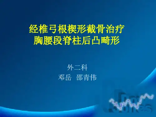 经椎弓根楔形截骨治疗胸腰段脊柱后凸畸形-外二科 邵青伟