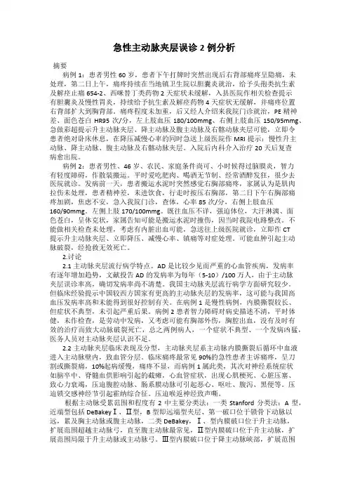 急性主动脉夹层误诊2例分析