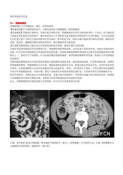 消化系统影像学征象