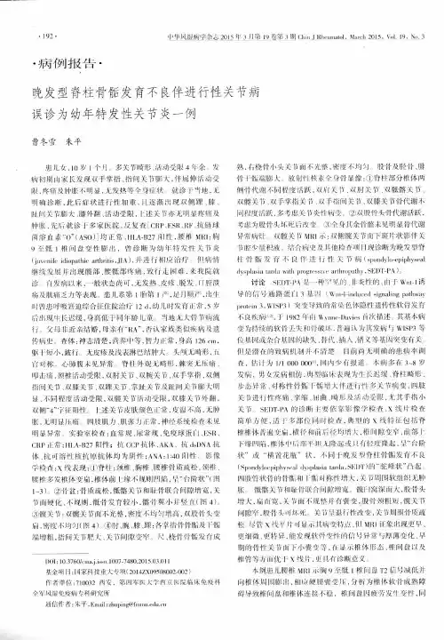 晚发型脊柱骨骺发育不良伴进行性关节病误诊为幼年特发性关节炎一例