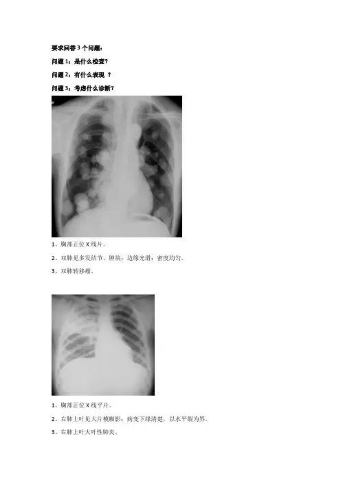 胸部X片
