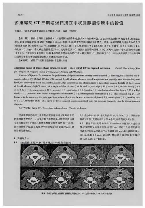 多排螺旋CT三期增强扫描在甲状腺腺瘤诊断中的价值