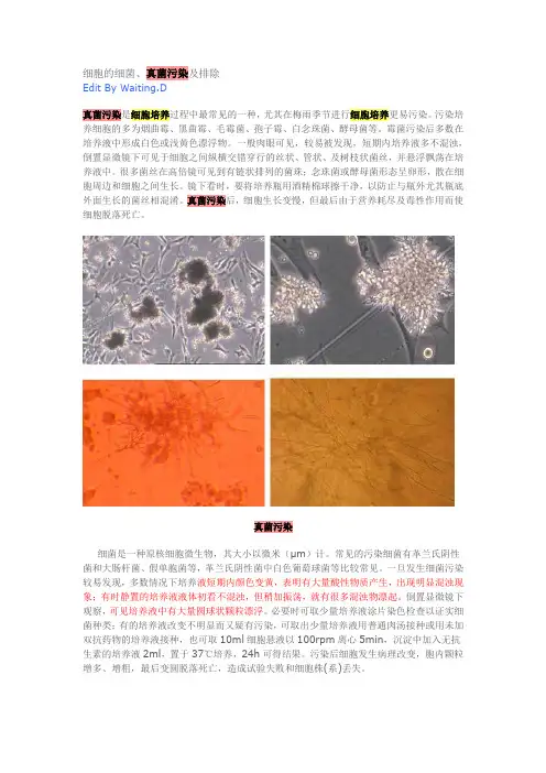 细胞的细菌、真菌污染及排除 2
