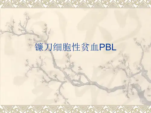 镰刀型细胞贫血症
