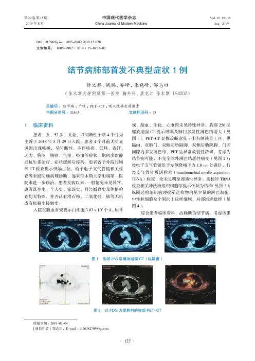 结节病肺部首发不典型症状1例