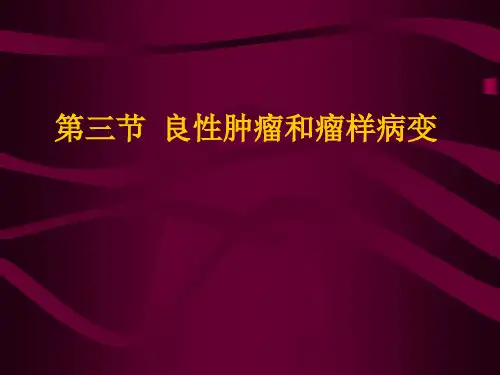 口腔颌面部良性肿瘤和瘤样病变