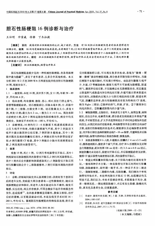 胆石性肠梗阻16例诊断与治疗