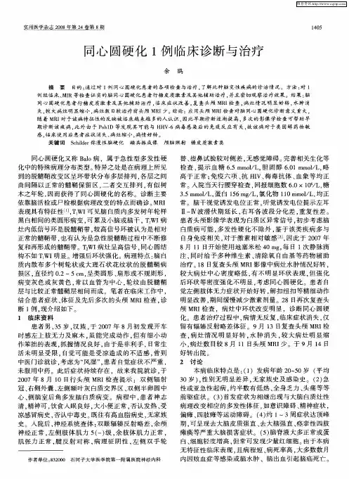 同心圆硬化1例临床诊断与治疗