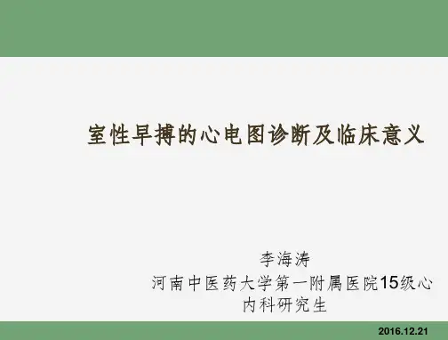 室性早搏的心电图诊断ppt课件