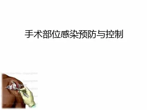 手术部位感染预防与控制