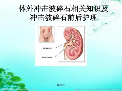 体外冲击波碎石术相关知识与及冲击波碎石前后护理