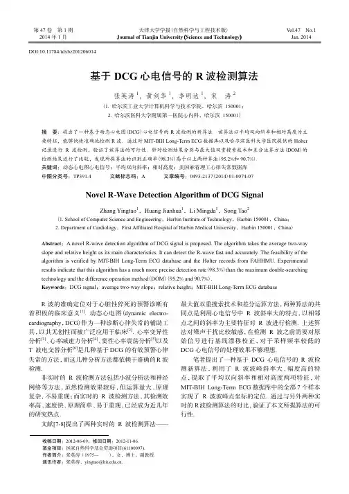 基于DCG心电信号的R波检测算法