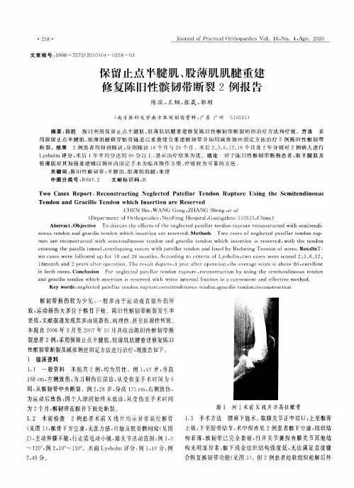 保留止点半腱肌、股薄肌肌腱重建修复陈旧性髌韧带断裂2例报告