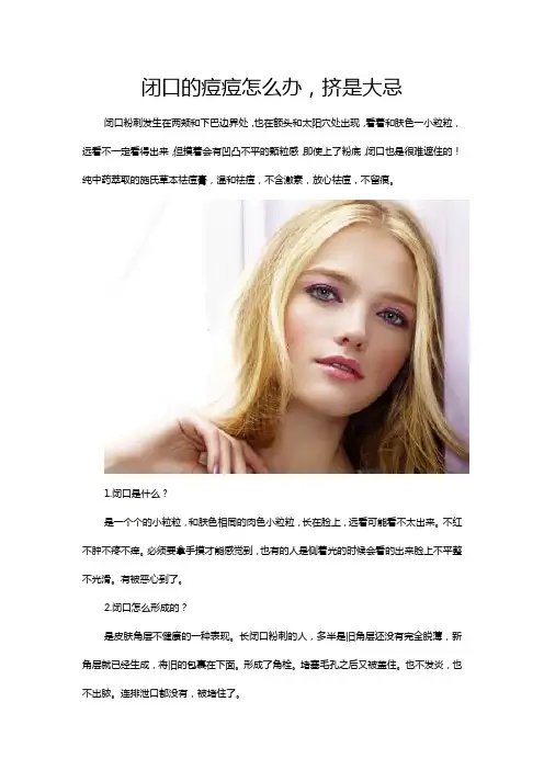 闭口的痘痘怎么办,挤是大忌