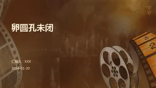 卵圆孔未闭演示课件
