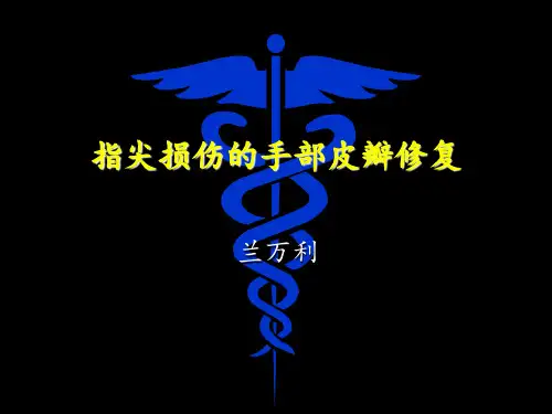 指尖损伤的手部皮瓣修复