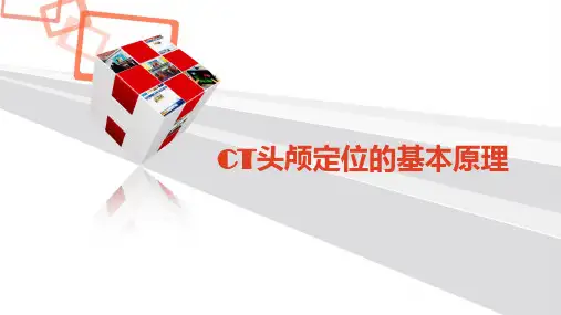 CT头颅定位的基本原理